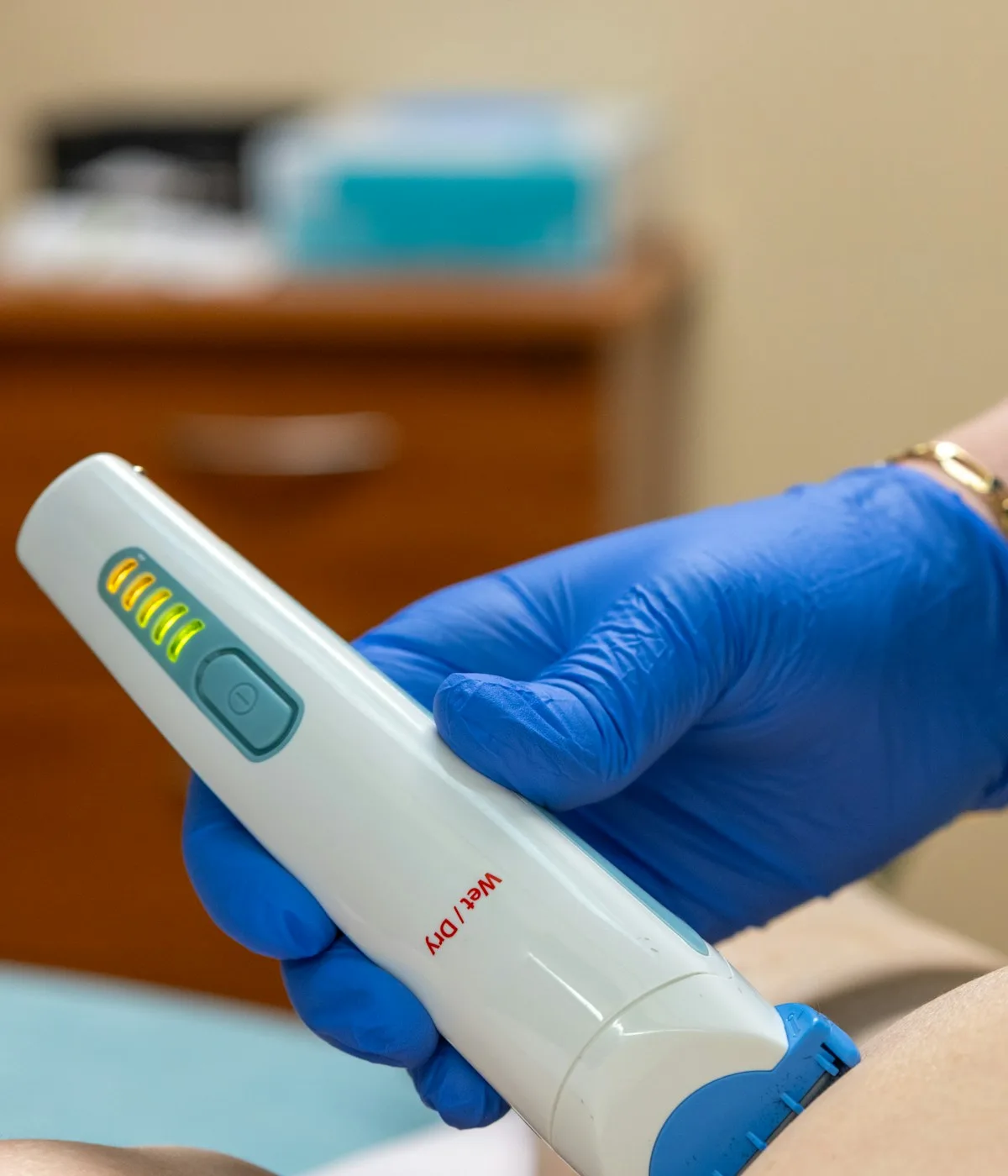 Equipo de láser médico de depilación en una sala de la clínica
