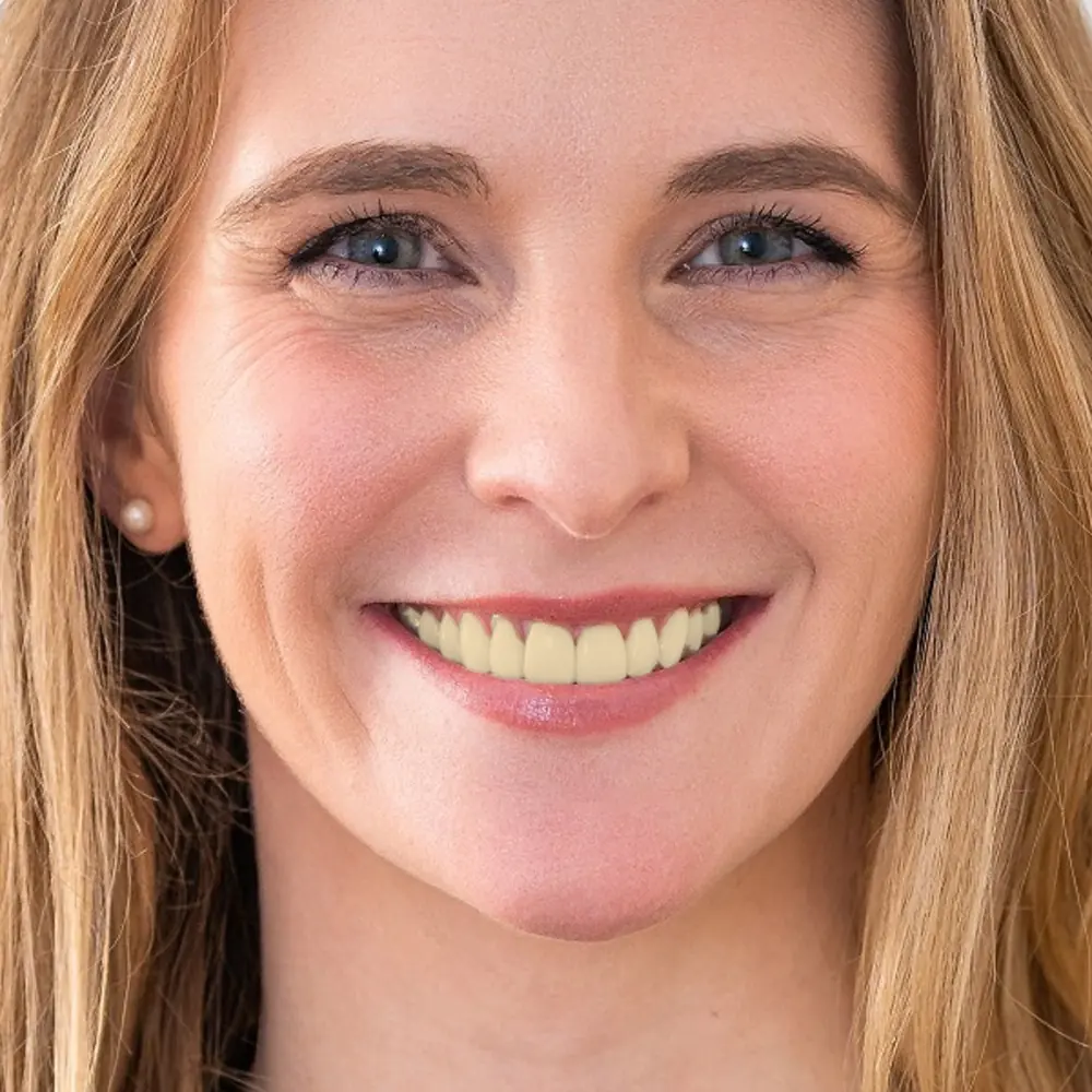Paciente de Clínica Velia sonriendo con naturalidad