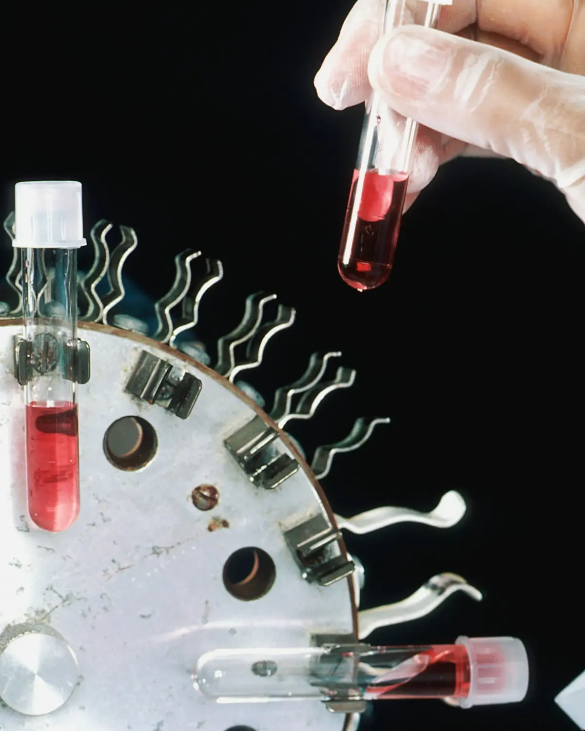 Sala de procedimientos preparada para una inseminación artificial