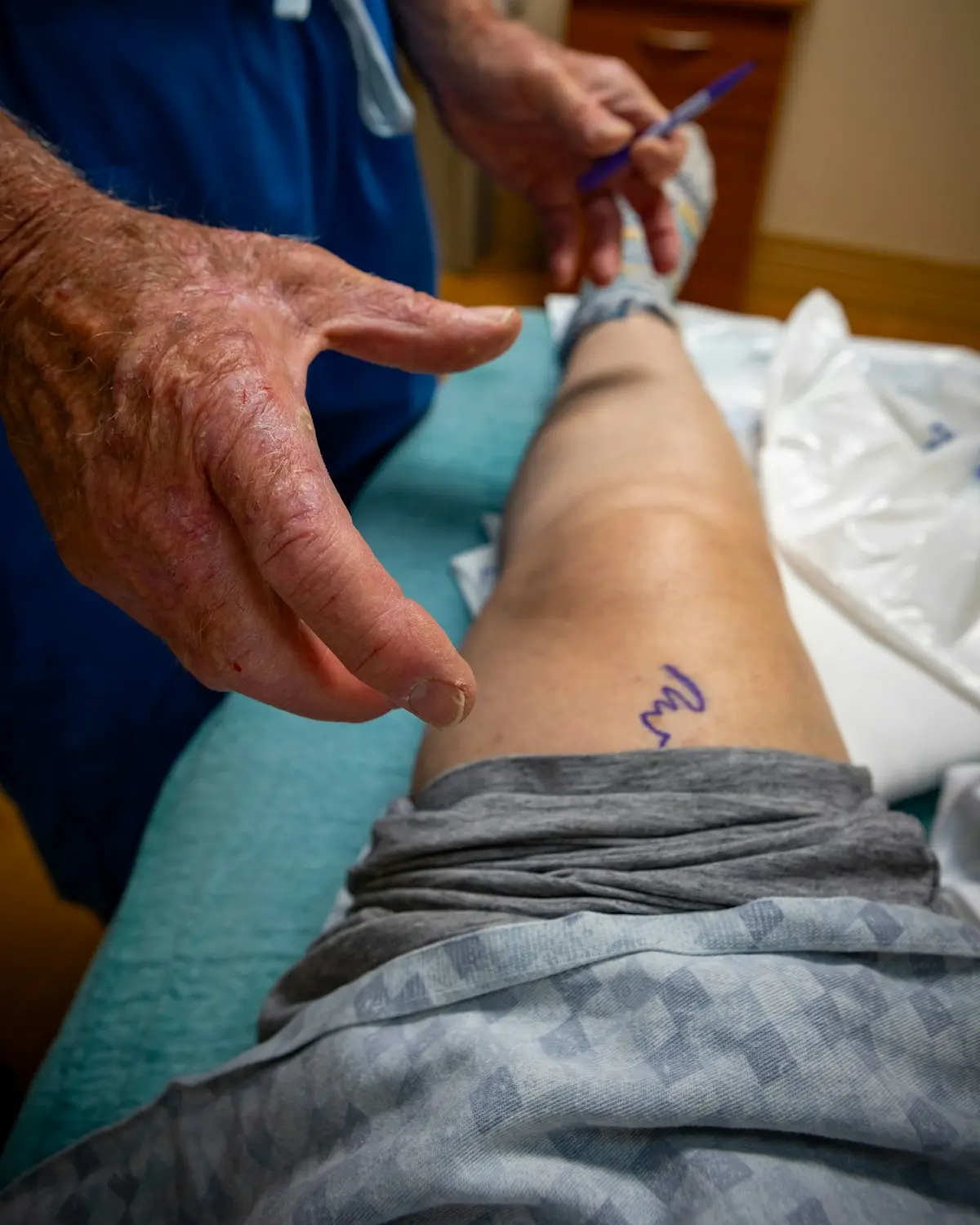 Radiografía de una prótesis de rodilla revisada por el traumatólogo